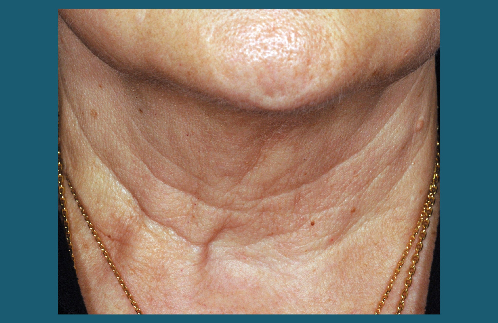 Before and After | Anti-Aging Skincare Products