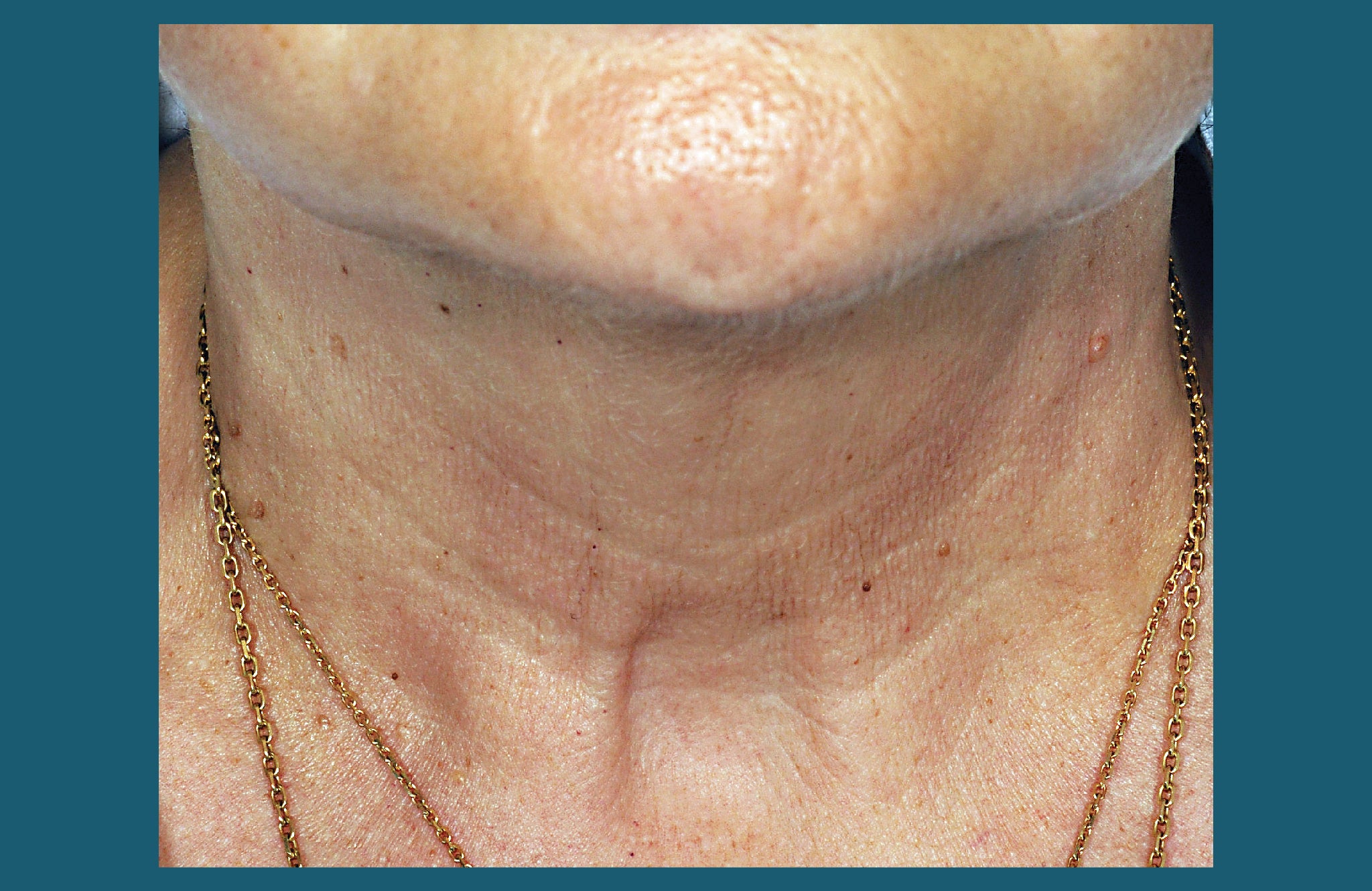 Before and After | Skincare Products