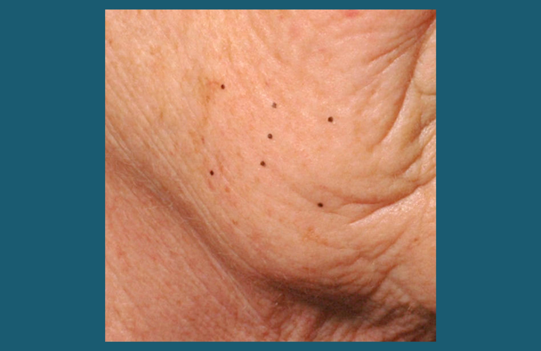 Before and After | Skincare Products | Skincare Solutions