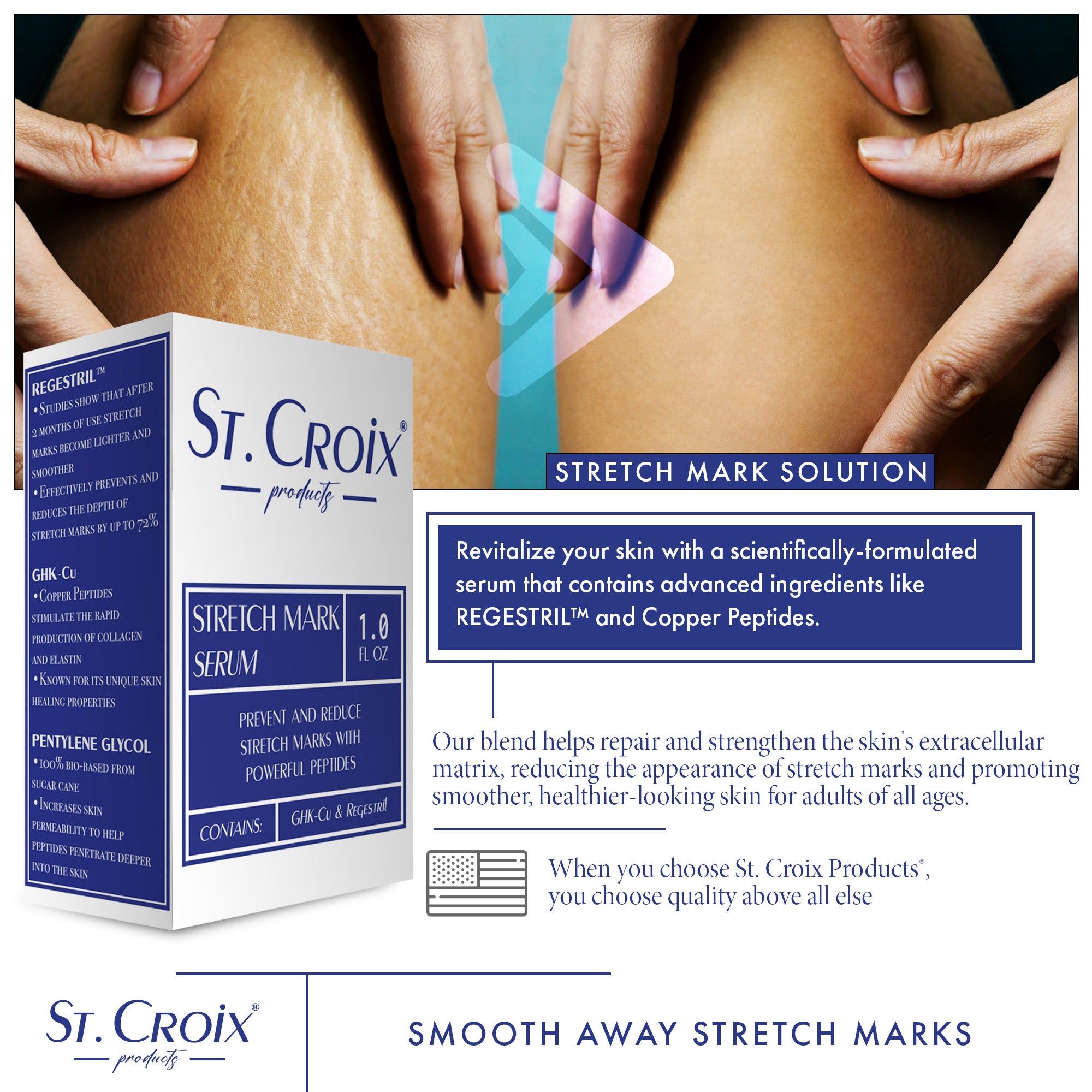 Stetch Mark Serum for repairing skin
