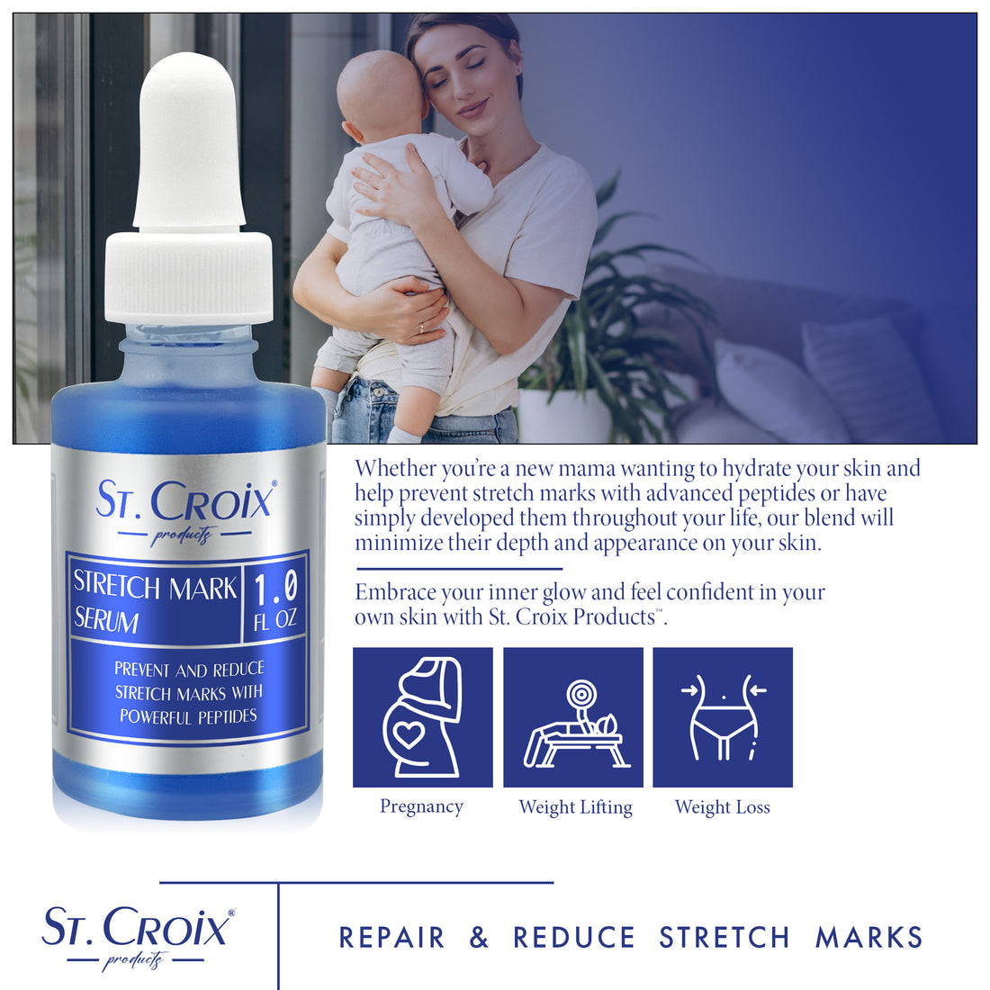 St. Croix Stretch Mark Serum for smoother skin